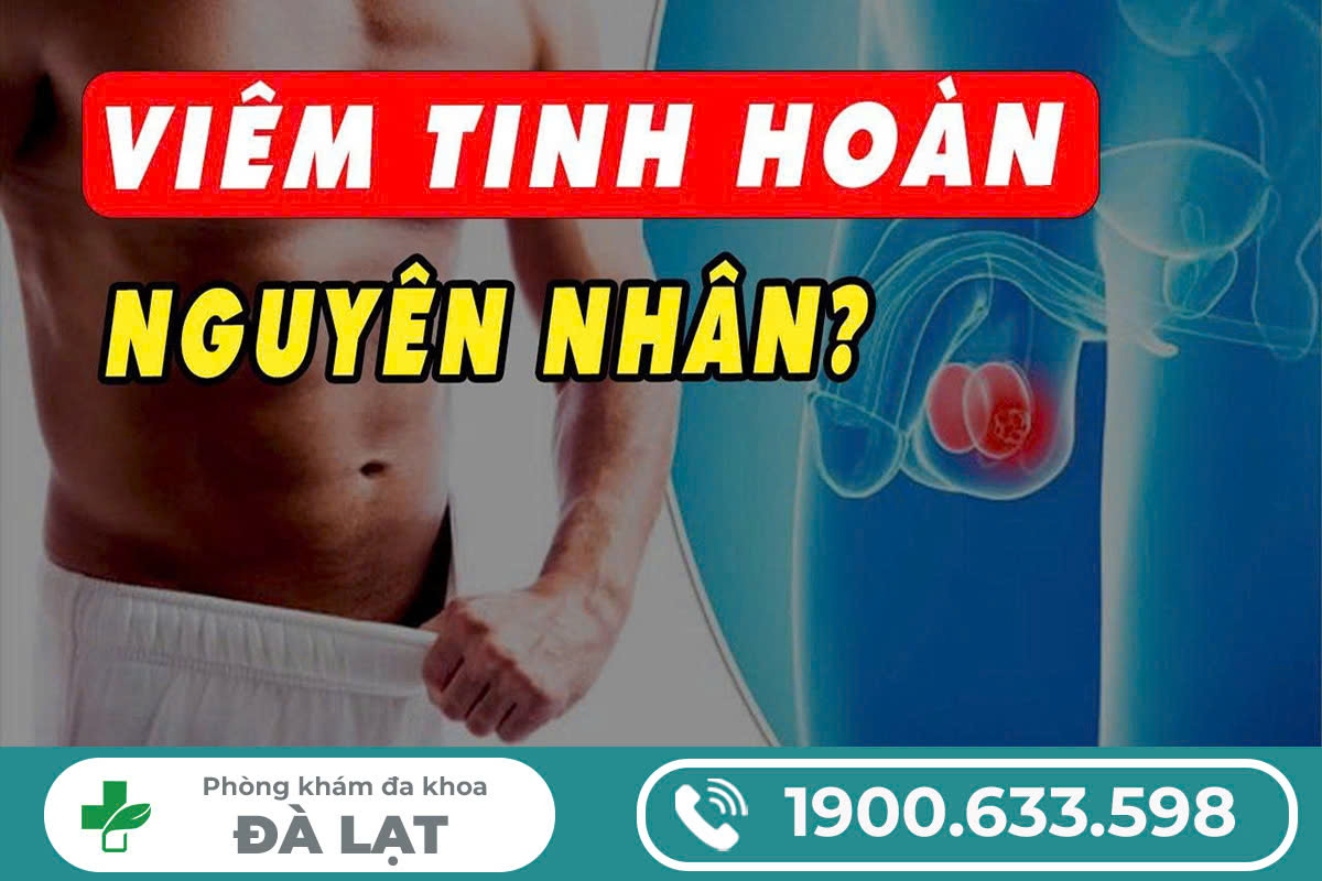 Hình ảnh minh họa